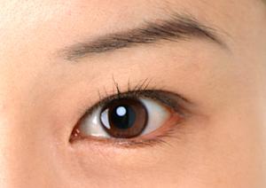 船橋で二重整形が評判のクリニック