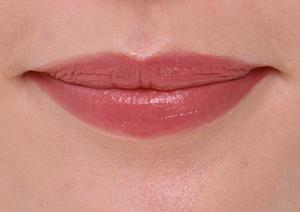 成城学園で選ぶ美容外科の決定版！安心・高品質な施術とサービスを徹底解説